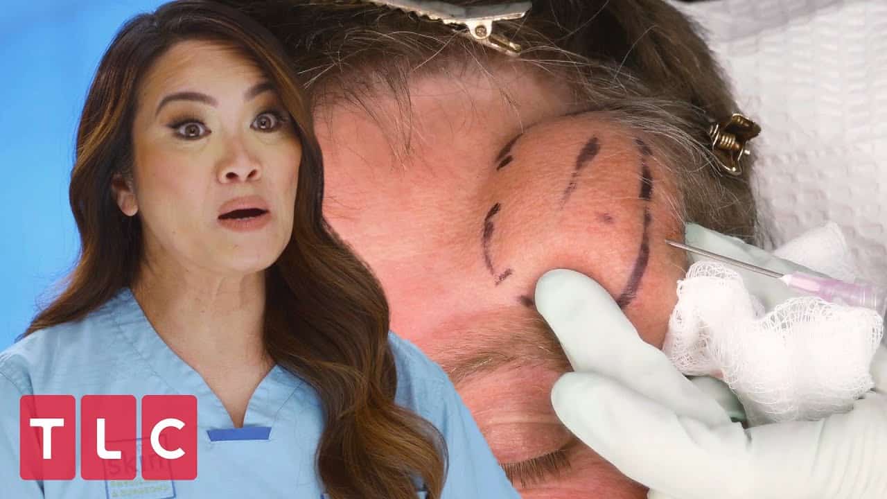 Dr. Lee Squeezes a Huge Hairy Cyst! | Dr. Pimple Popper