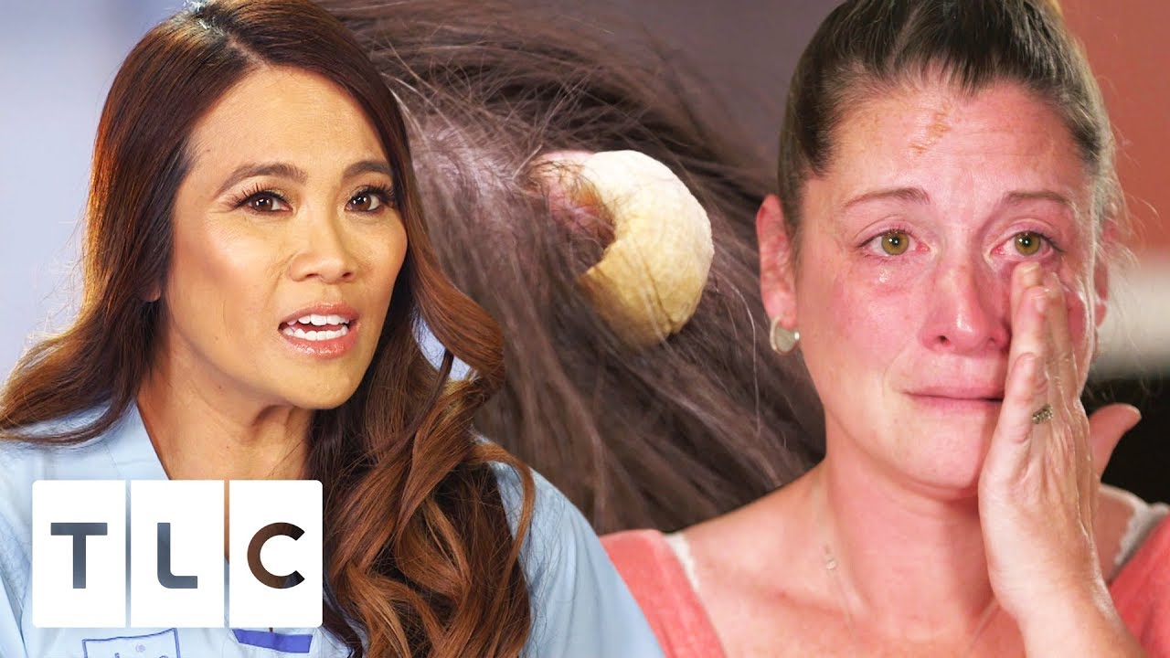 Dr. Pimple Popper Removes A Potentially Cancerous Horn | Dr. Pimple Popper