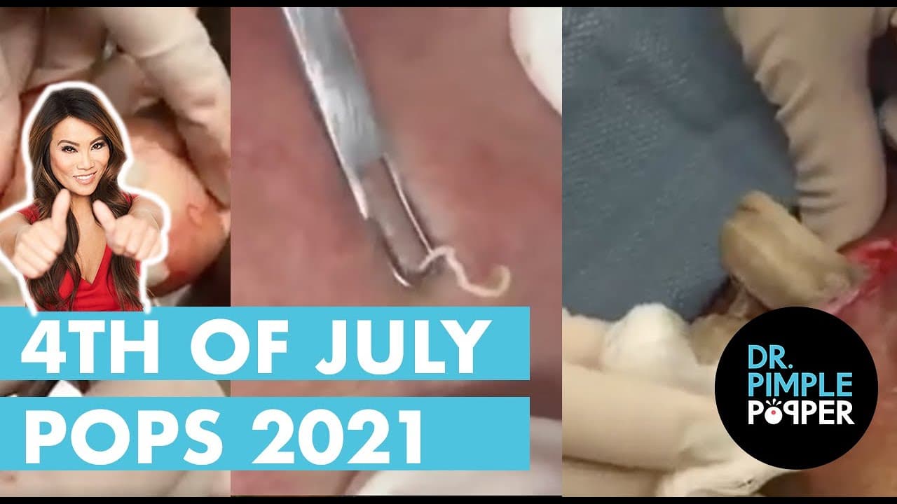 Dr. Pimple Popper’s 4th of July Pops & Fireworks Spectacular! 2021