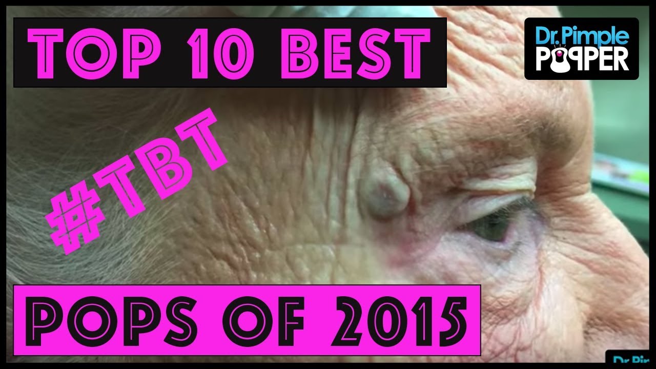 Dr Pimple Popper's BEST OF 2015!! Throwback Thursday!!