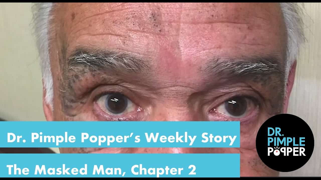 Dr. Pimple Popper’s Weekly Story Time: The Masked Man, Chapter 2!
