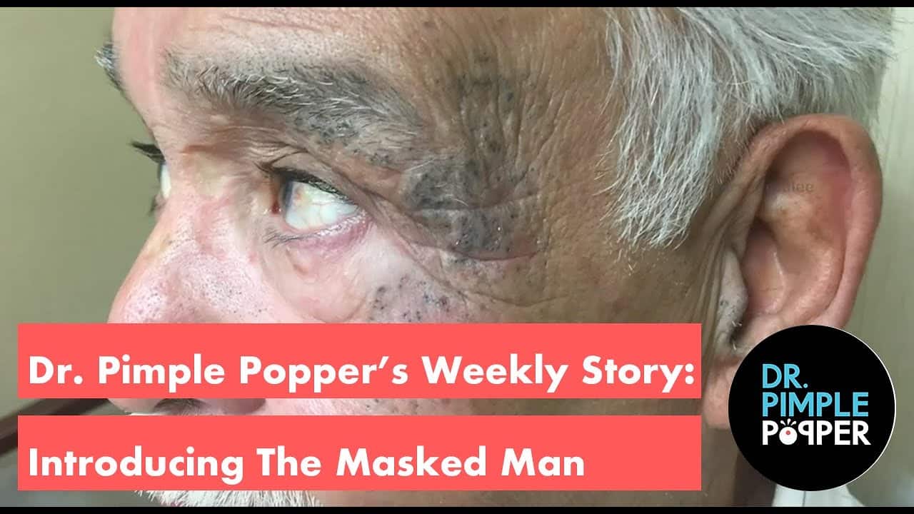 Dr. Pimple Popper’s Weekly Story Time: Introducing the Masked Man!