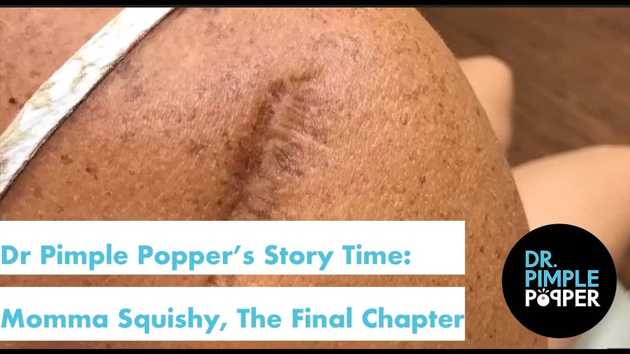 Dr. Pimple Popper’s Weekly Story Time: Momma Squishy, The Final Chapter