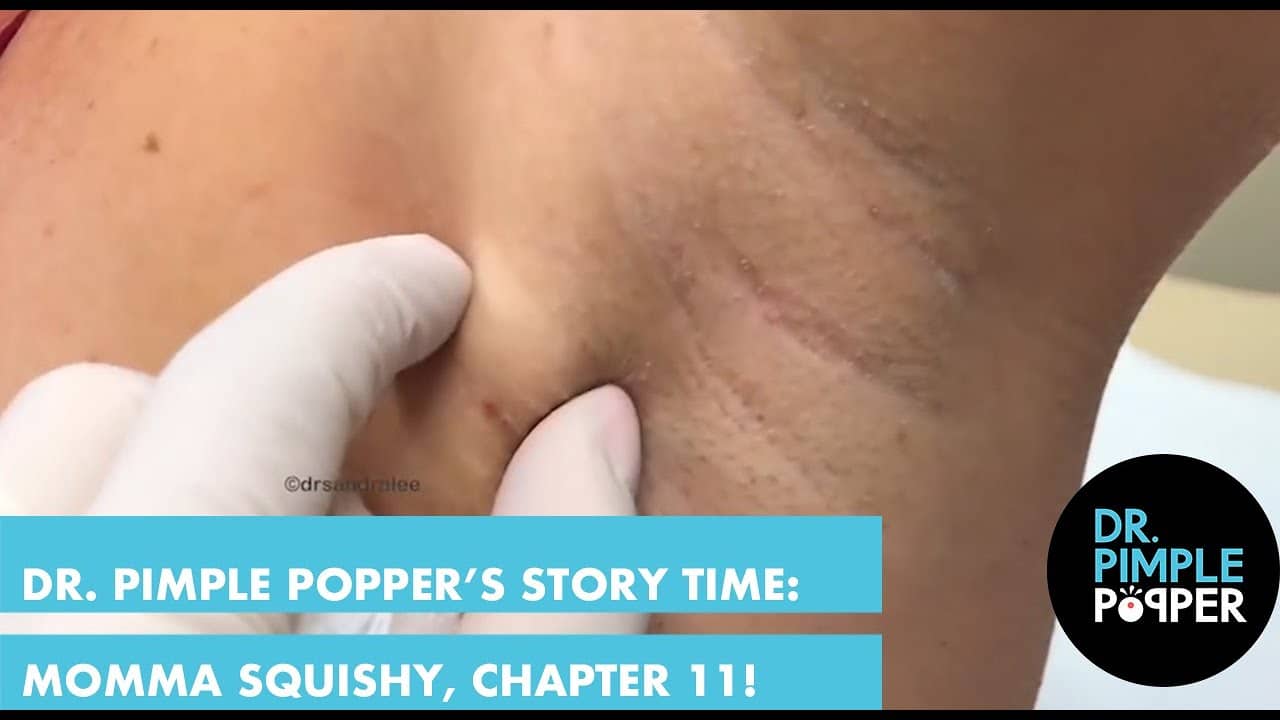 Dr. Pimple Popper’s Weekly Story Time: Momma Squishy, Chapter 11