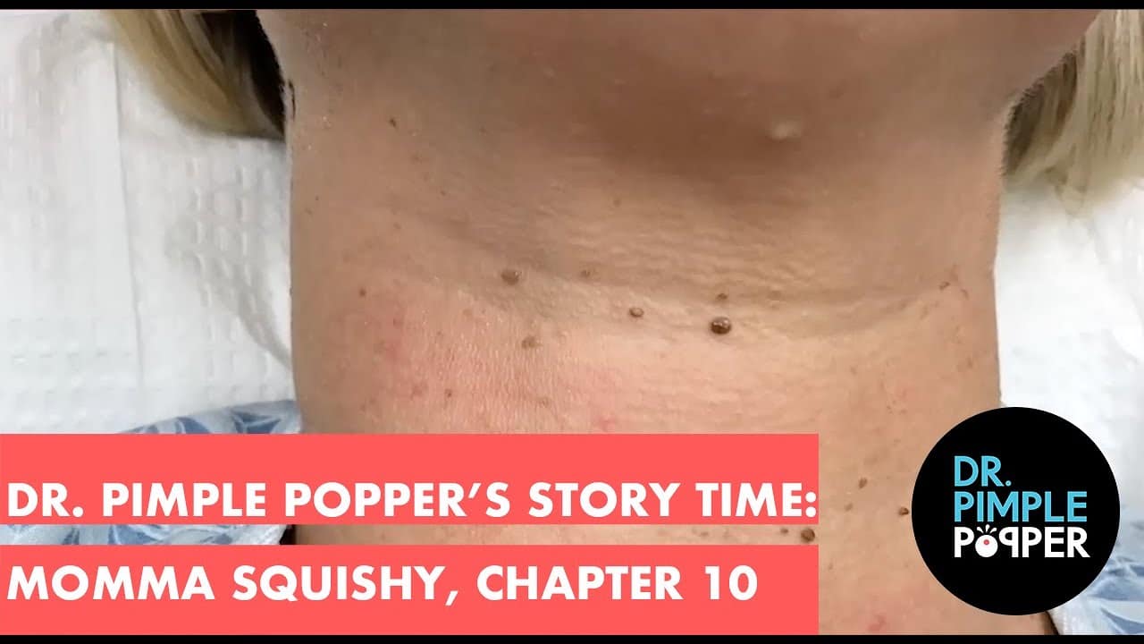 Dr. Pimple Popper's Weekly Story Time: Momma Squishy, Chapter 10!