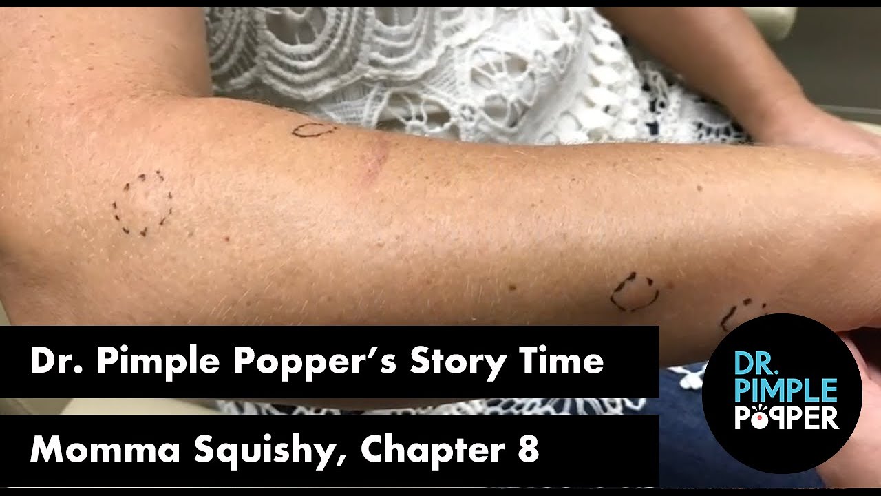 Dr. Pimple Popper’s Weekly Story Time: Momma Squishy, Chapter 8!