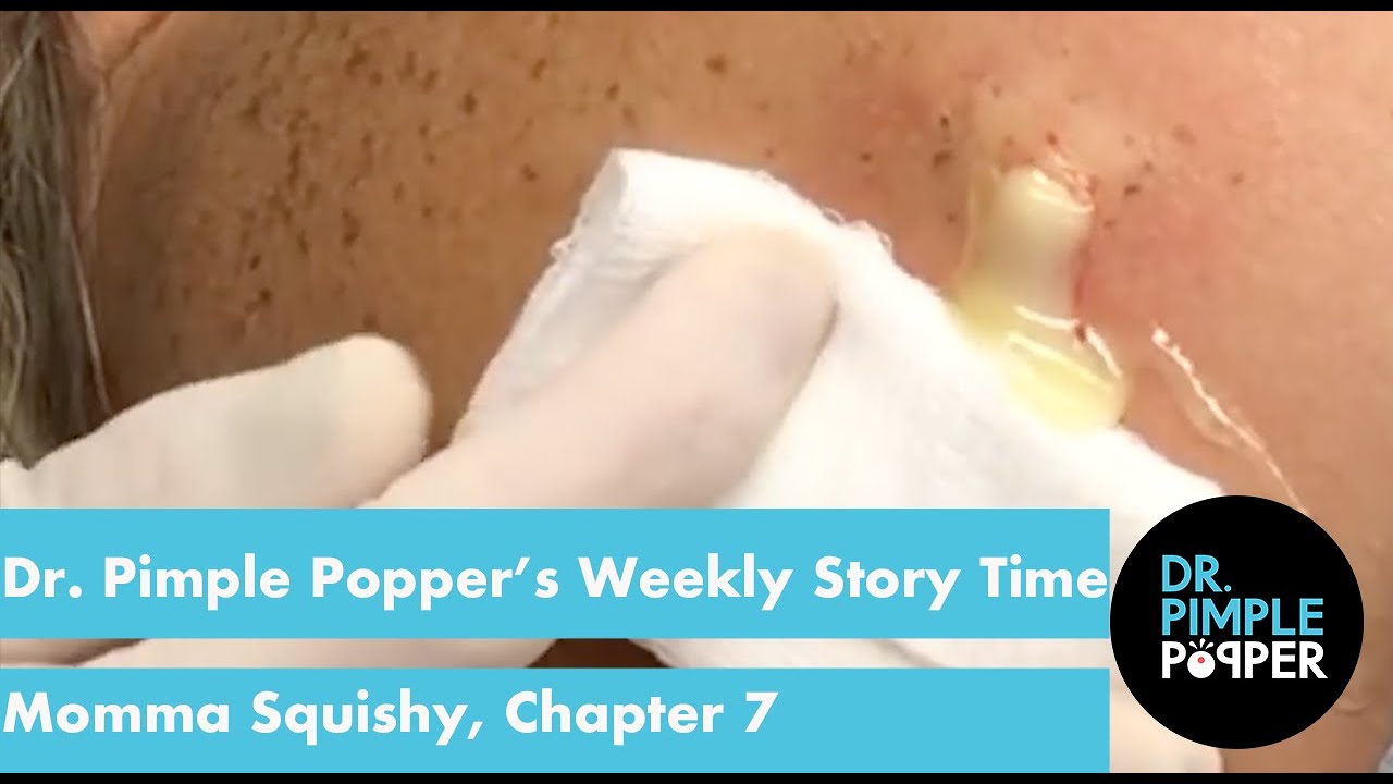 Dr. Pimple Popper's Weekly Story Time: Momma Squishy, Chapter 7