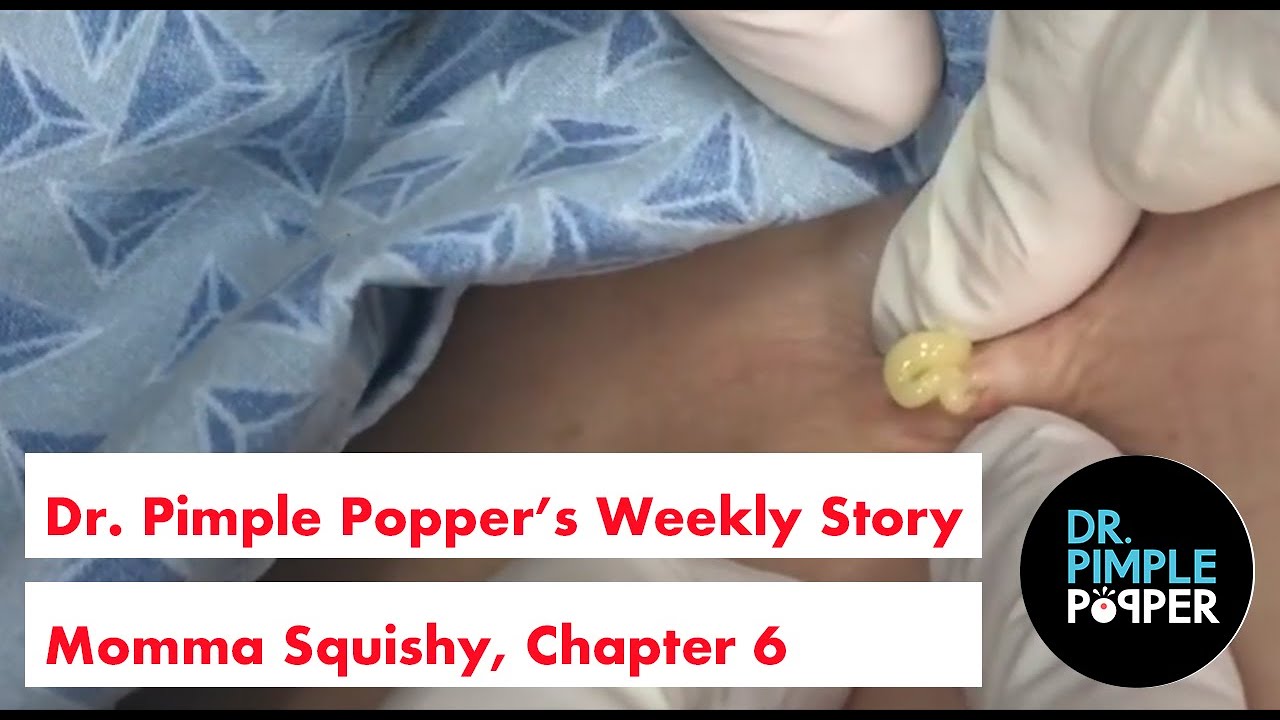 Dr. Pimple Popper’s Weekly Story Time: Momma Squishy, Chapter 6