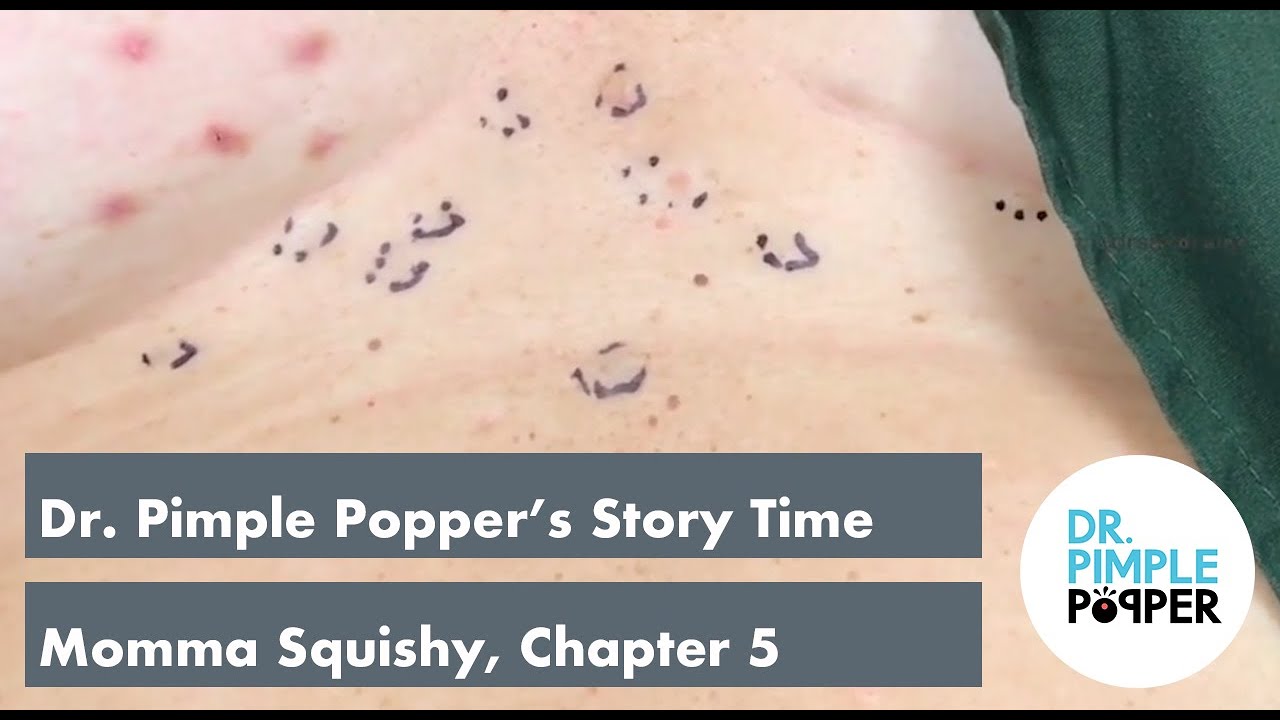Dr. Pimple Popper’s Weekly Story Time: Momma Squishy, Chapter 5