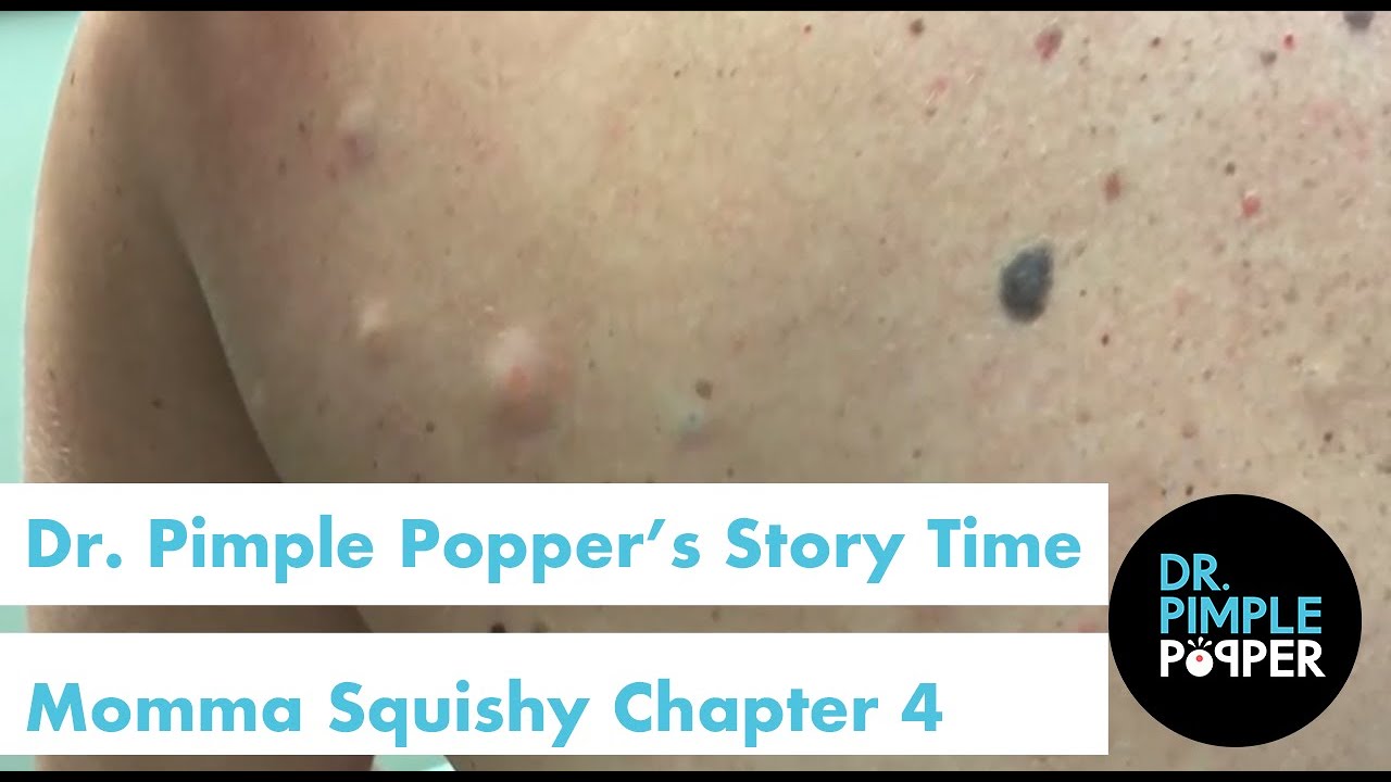 Dr. Pimple Popper's Weekly Story Time: Momma Squishy, Chapter 4