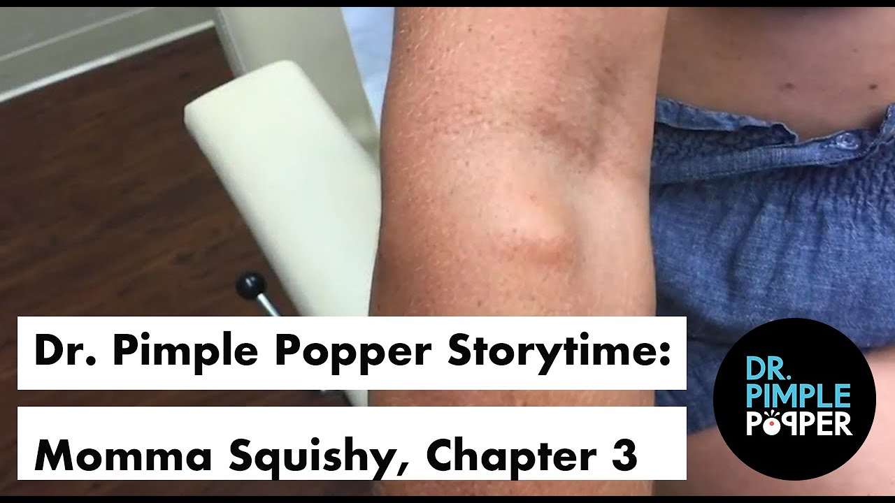 Dr. Pimple Popper’s Weekly Story Time: Momma Squishy, Chapter 3