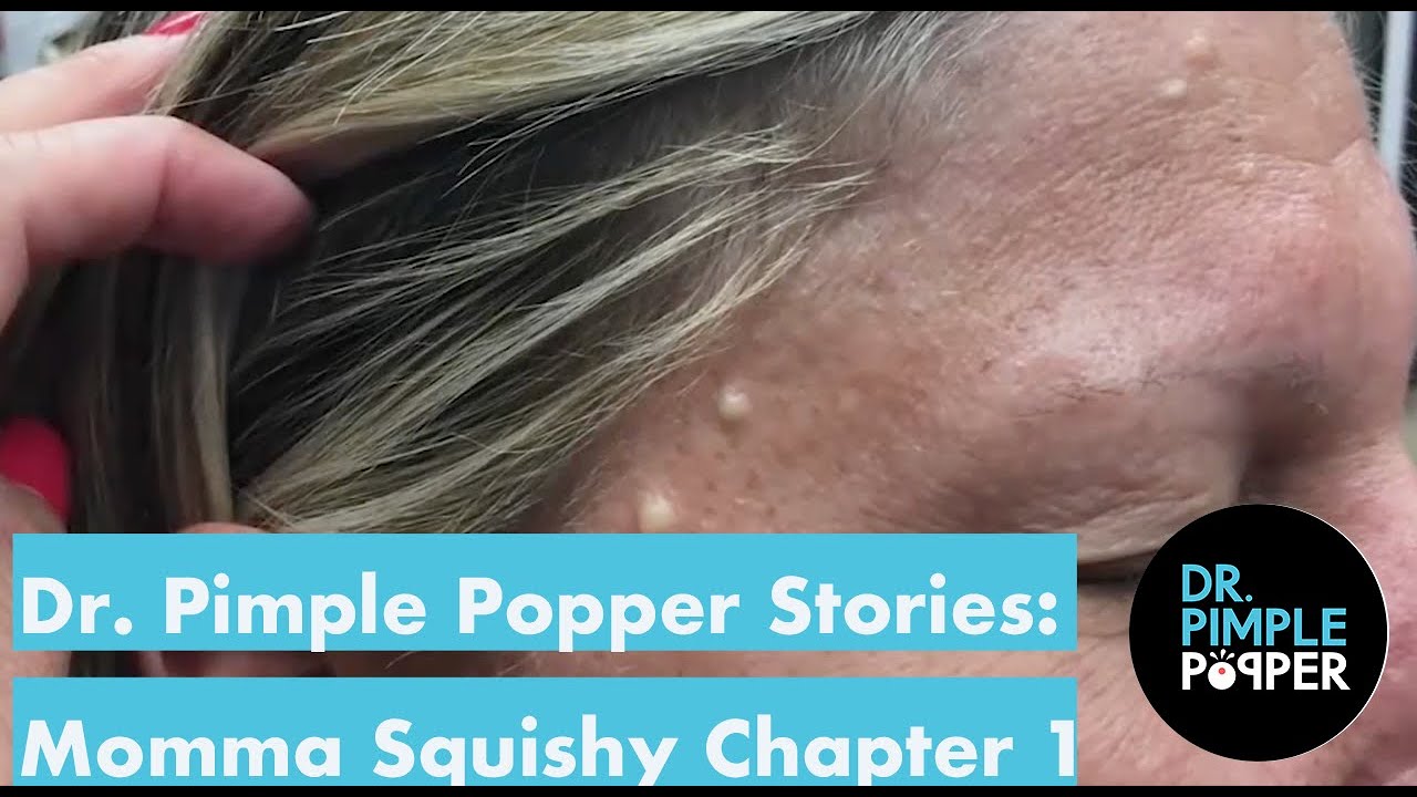 Dr. Pimple Popper’s Weekly Story Time: Momma Squishy, Chapter 1