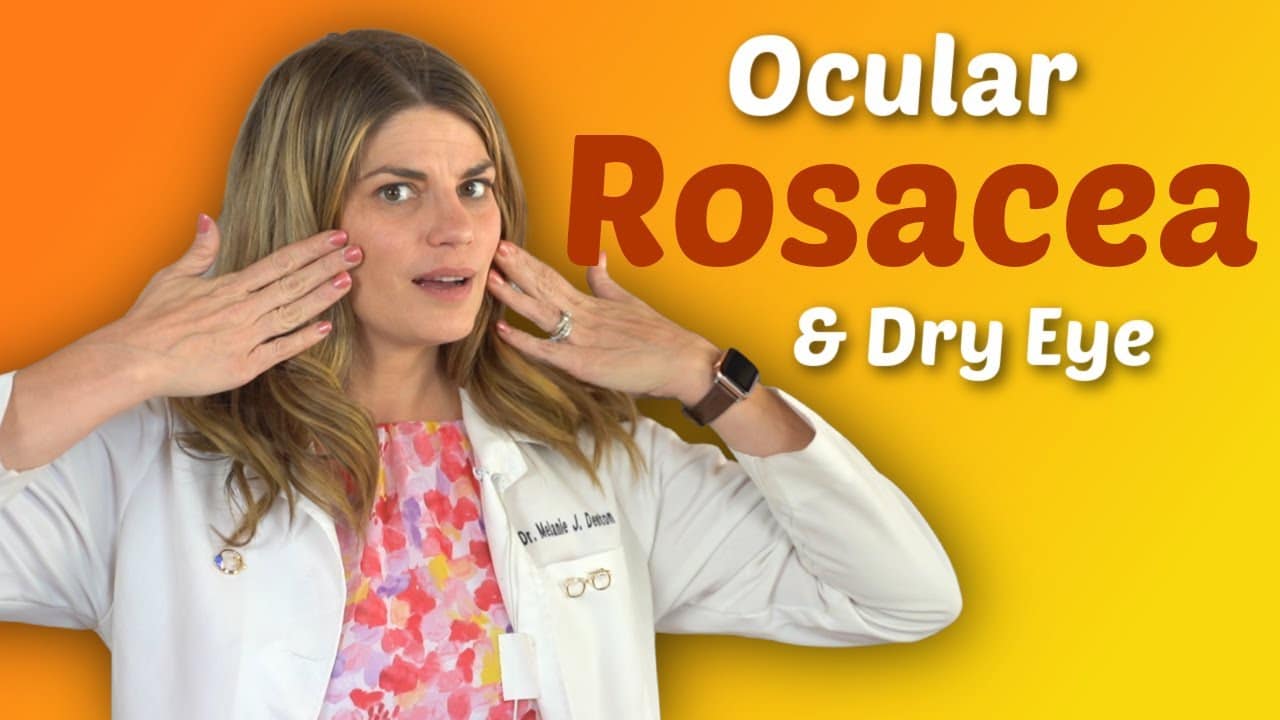 Dry Eye And Ocular Rosacea | What Is Ocular Rosacea And How To Treat It