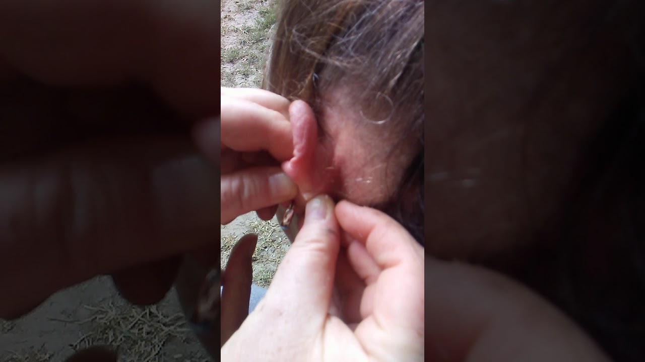 Ear zit impussable