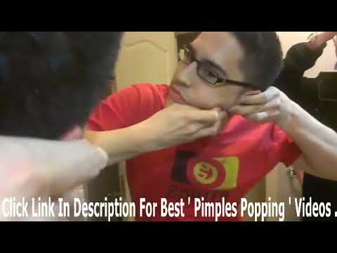 Earlobe Pimple Popping Of The Week 2018   YouTube