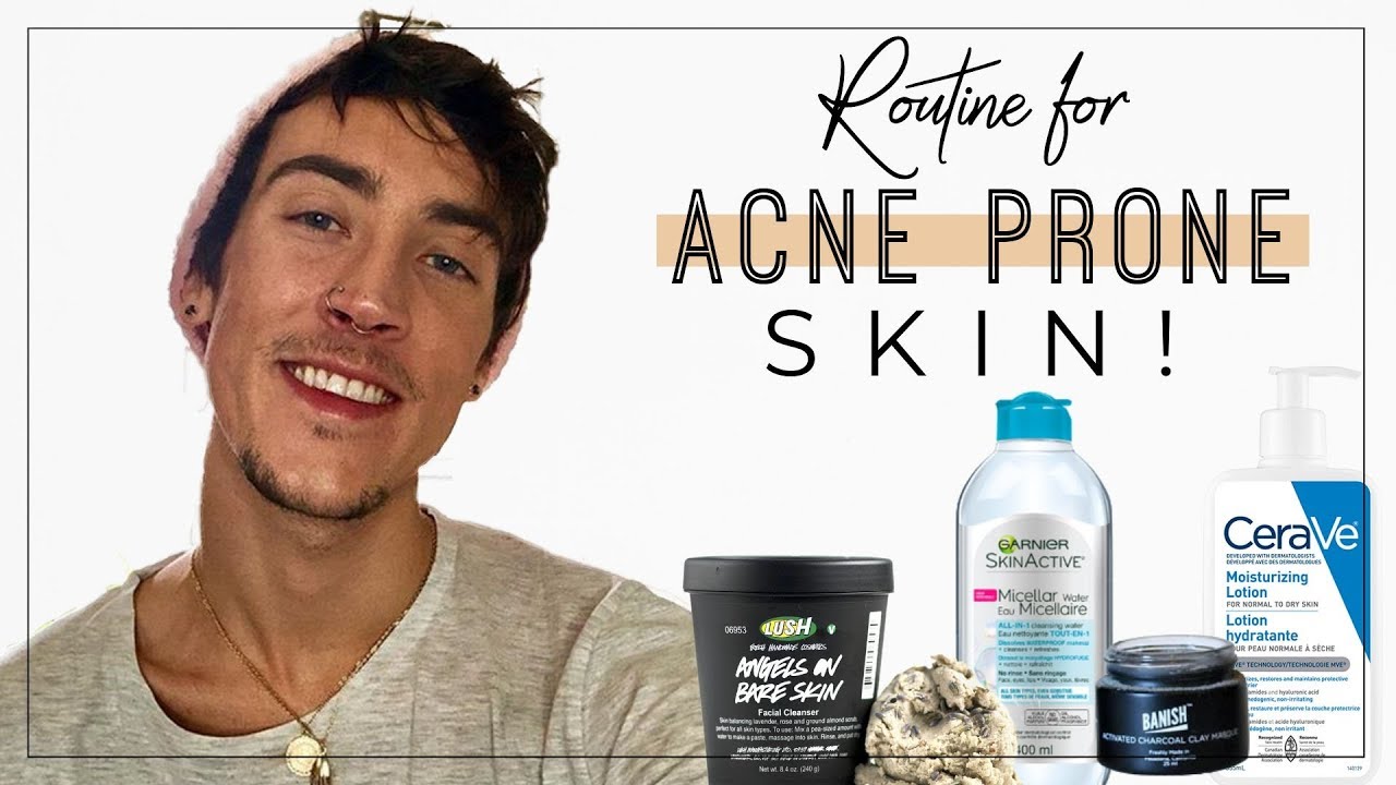 Easy Skincare Routine for Acne Prone Skin