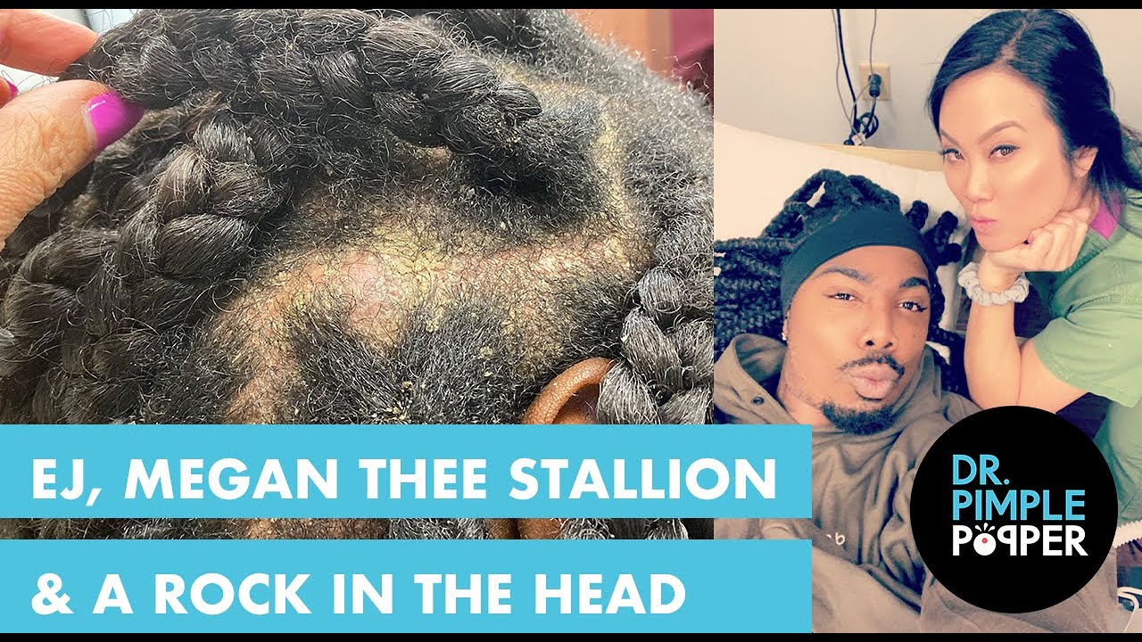 EJ, Megan Thee Stallion & a Rock in the Head