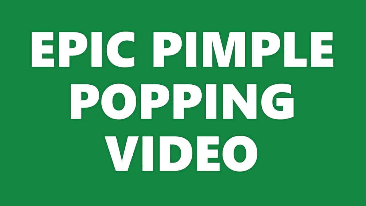 EPIC PIMPLE POPPING VIDEO!
