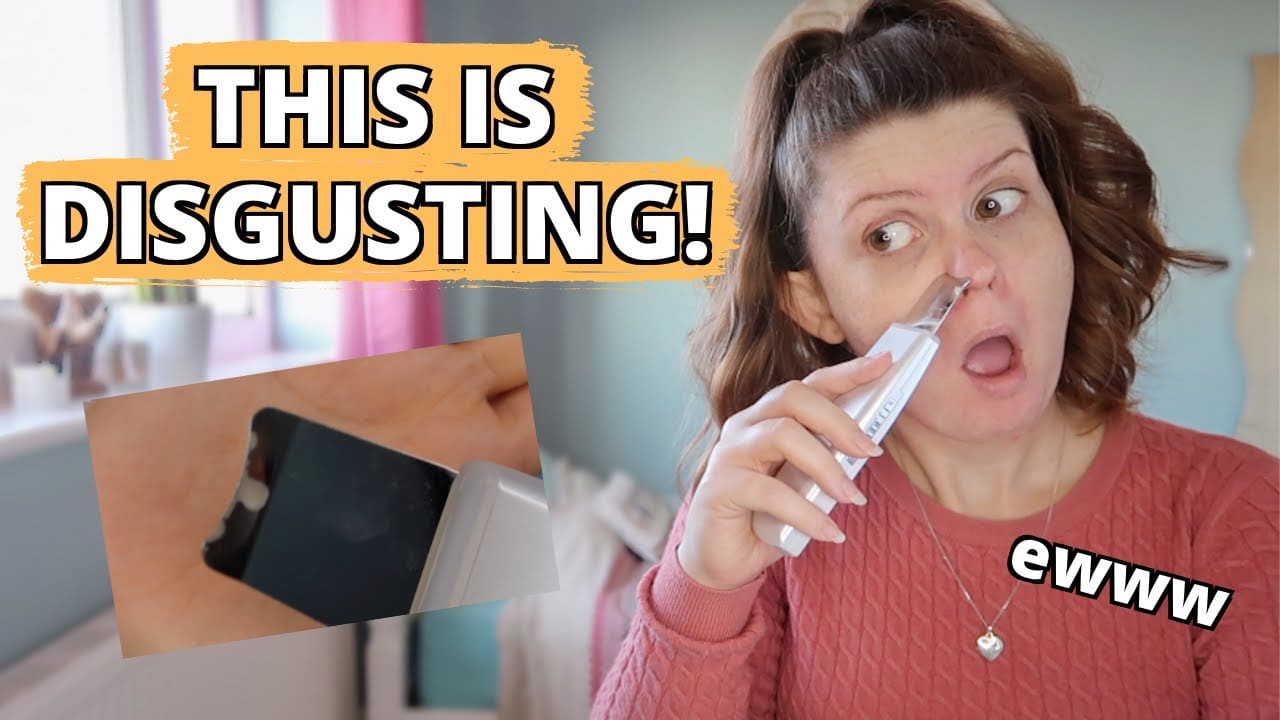 EXTRACTING BLACKHEADS WITH AN ULTRASONIC SKIN SPATULA | My Skincare Journey 2021
