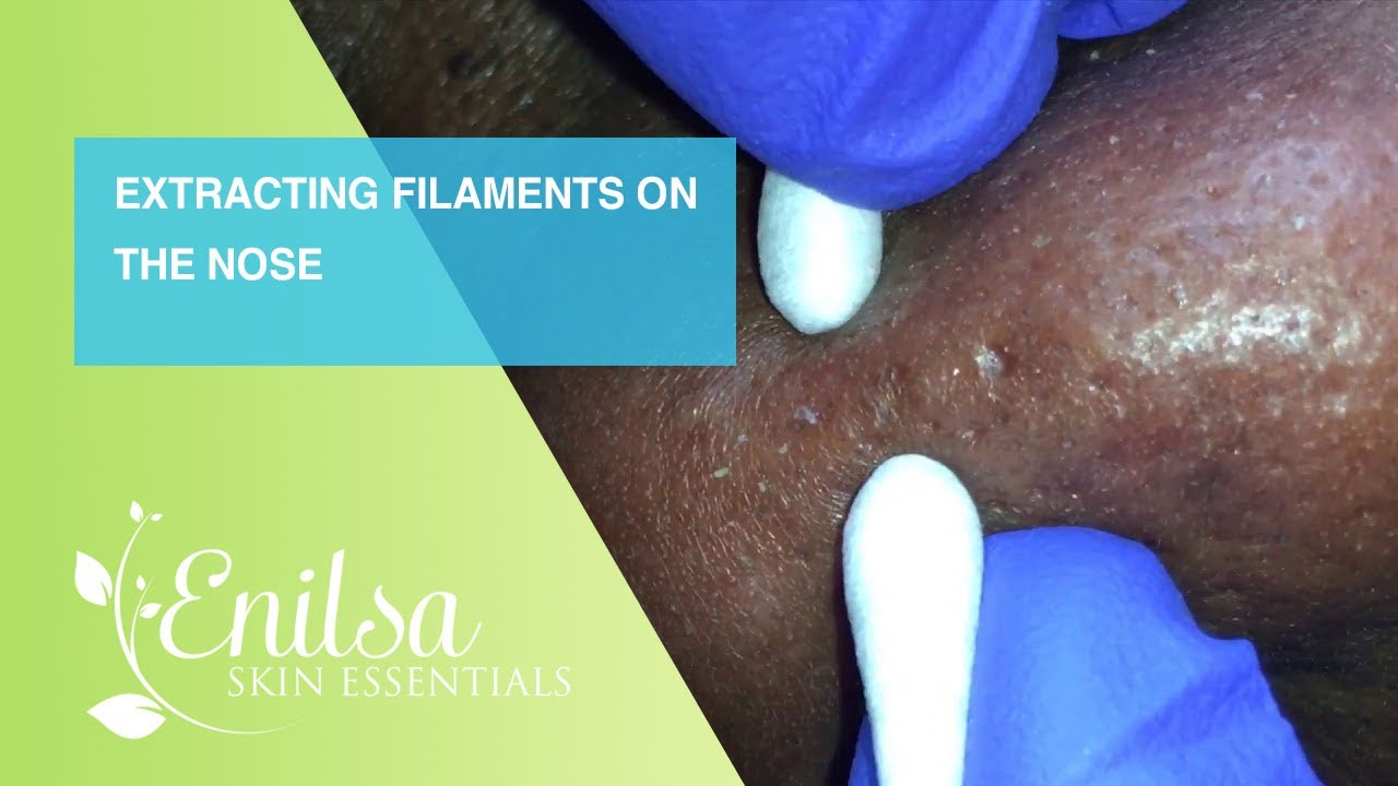 Extracting Filaments On The Nose