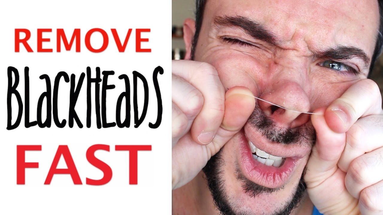GET RID of BLACKHEADS FAST…w/ DENTAL FLOSS? | Does It Really Work? | Cheap Tip #256