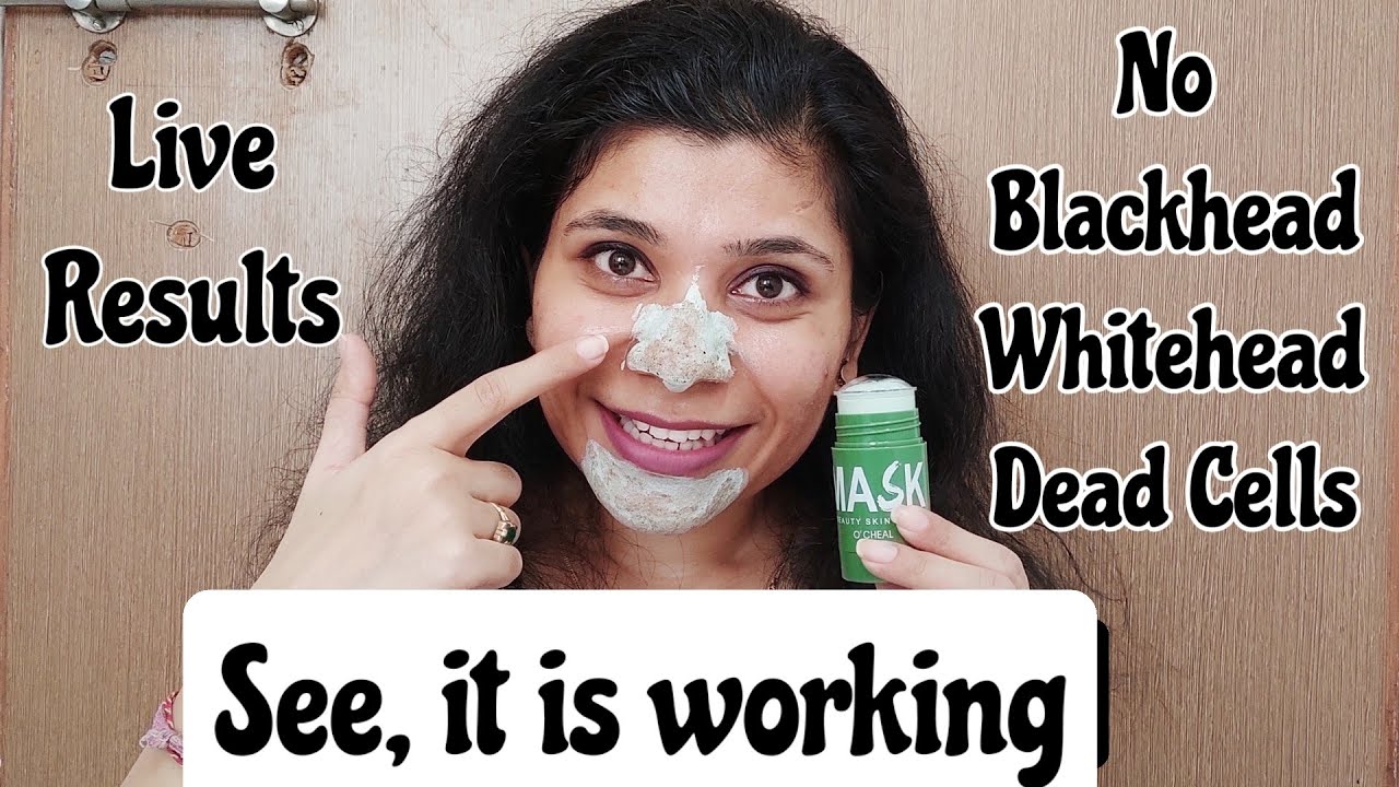 Green Mask Stick/Viral mask | Product to remove blackheads, Whiteheads & pigmentation instantly
