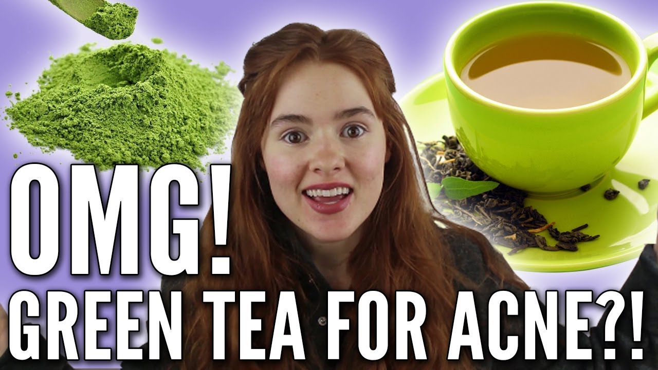 Green Tea: Bulletproof Treatment for Acne At Home?!