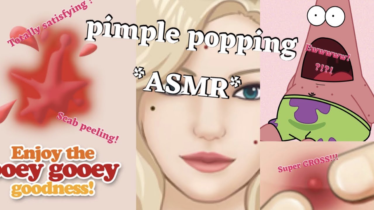 GROSSEST pimple popping EVER!!!…*ASMR*