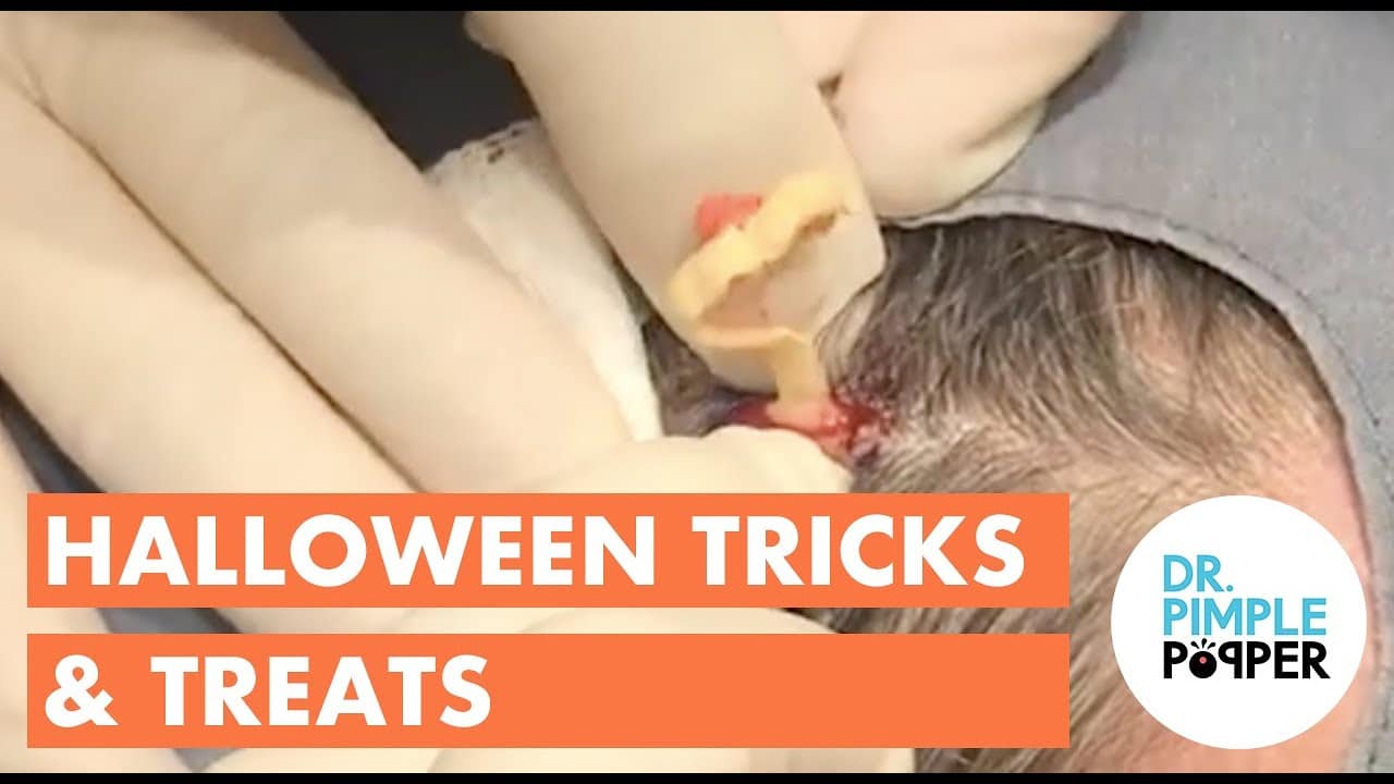 Halloween Tricks & Treats with Dr. Pimple Popper