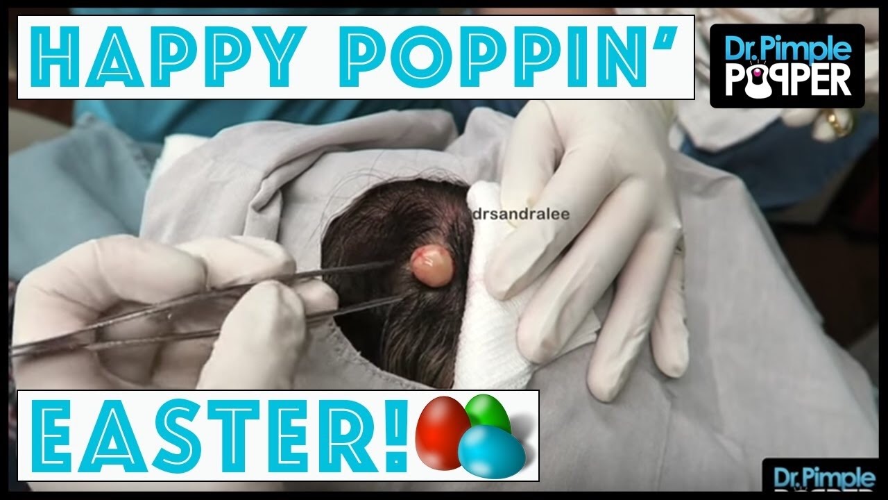 Happy 🥚 Easter!! 🐣 From Dr Pimple Popper