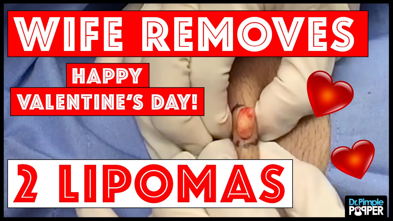 Happy Popping this Valentine’s Day! 👉🏼❤️👈🏼