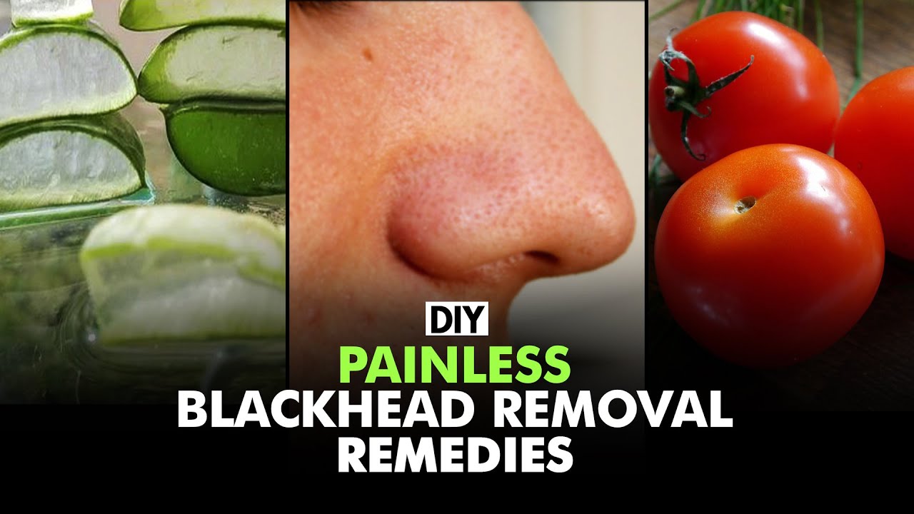 Home Remedies To Remove Blackheads | DIY | Fit Tak