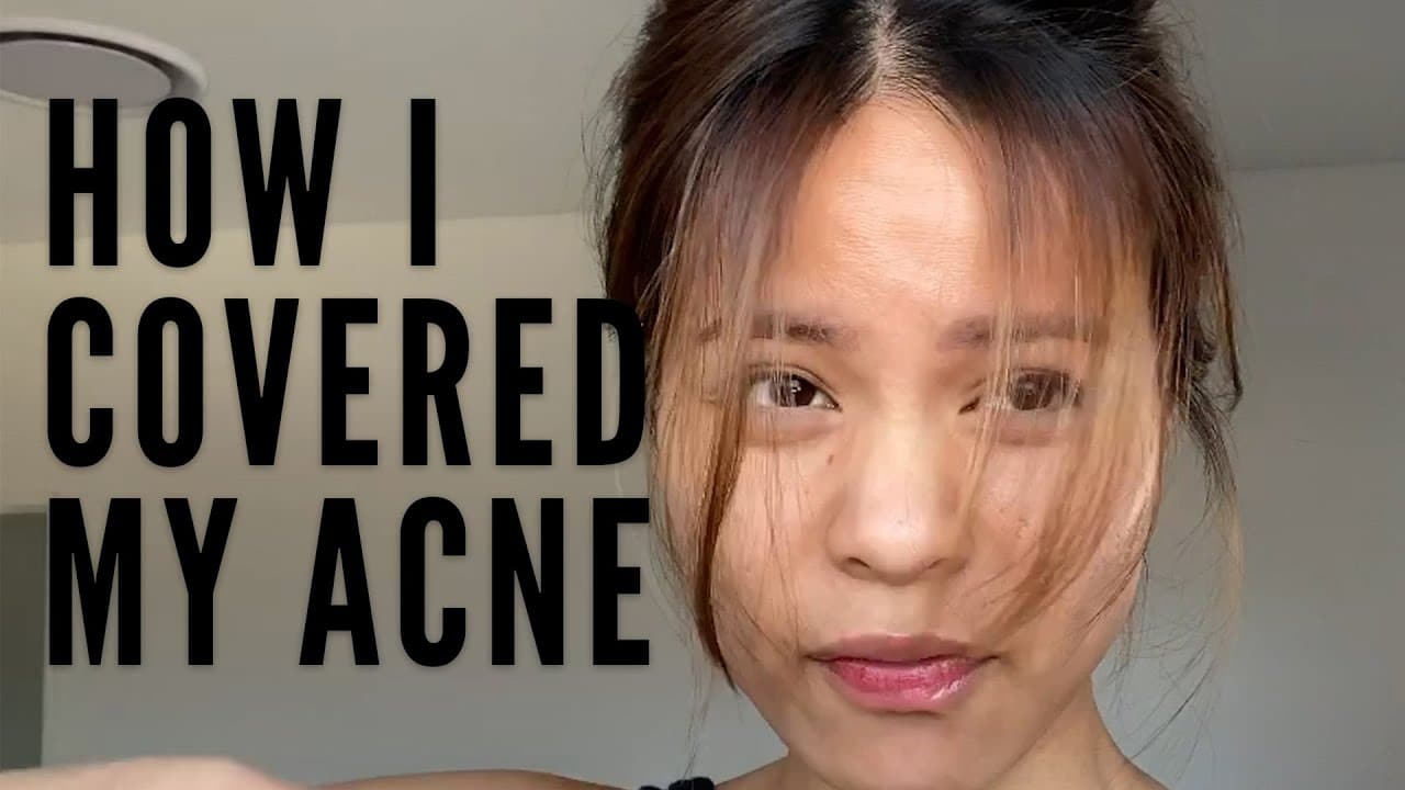 How I Covered My Acne and Acne Scars | Banish Warriors
