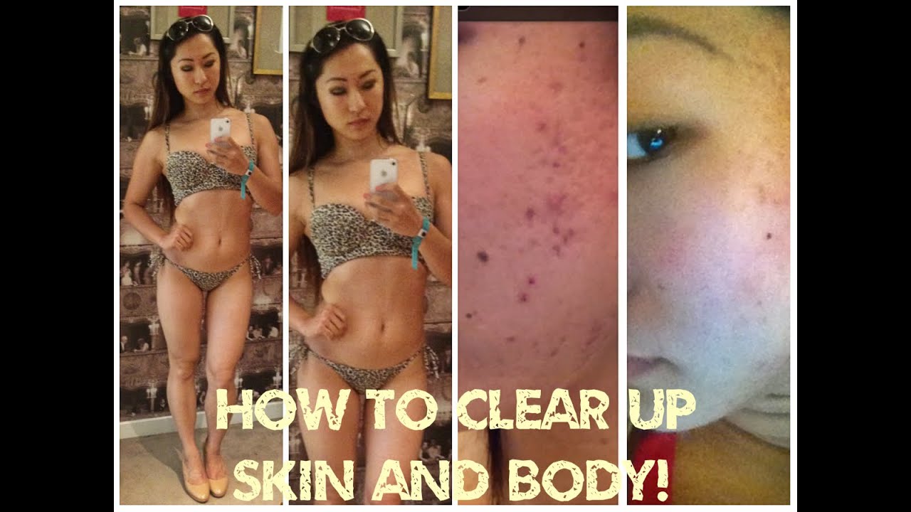 HOW I’VE BEEN KEEPING MY SKIN CLEAR + WEIGHT LOSS TIPS