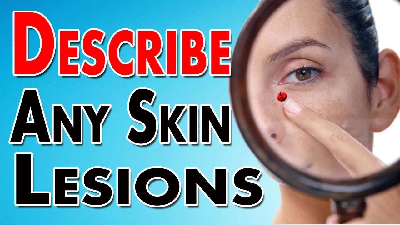 How to Correctly Describe Any Skin Lesion (Macule, Patch, Papule, Plaque, Pustule, Nodules, Vesicle)
