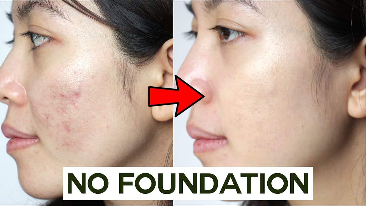How to Cover Acne & Blemishes WITHOUT Foundation  • easy & non cakey