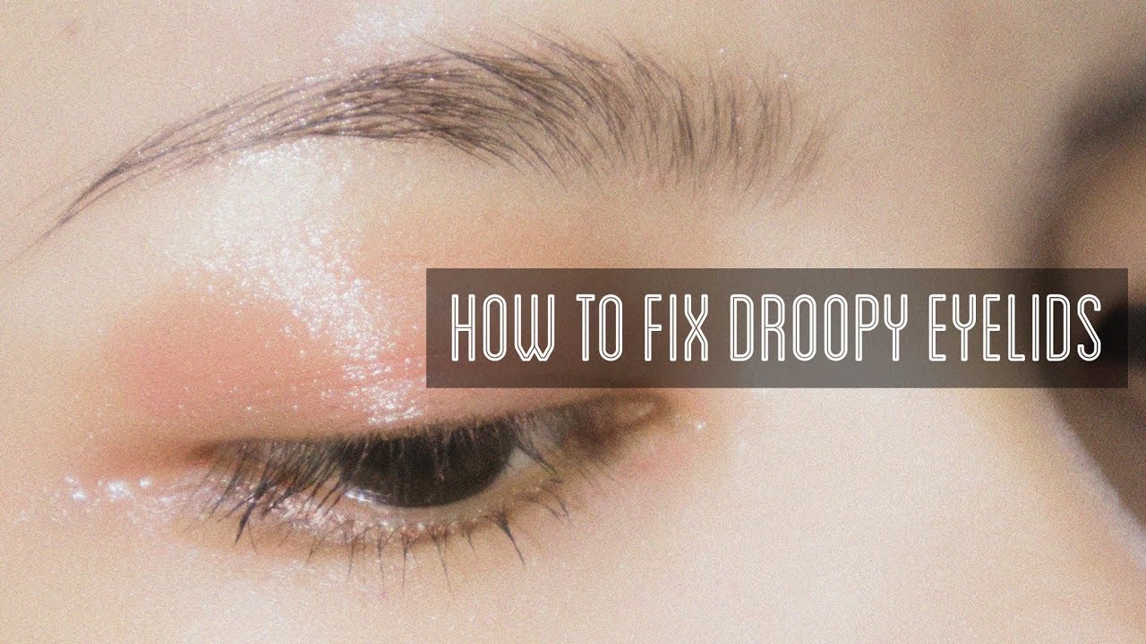How to Fix Droopy Eyelids