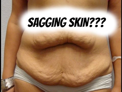 HOW TO GET RID OF SAGGING SKIN #TMITUESDAYS
