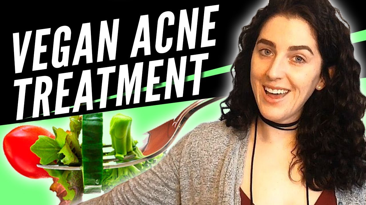 How to Get Rid of Vegan Acne (Banish Kit Giveaway!)