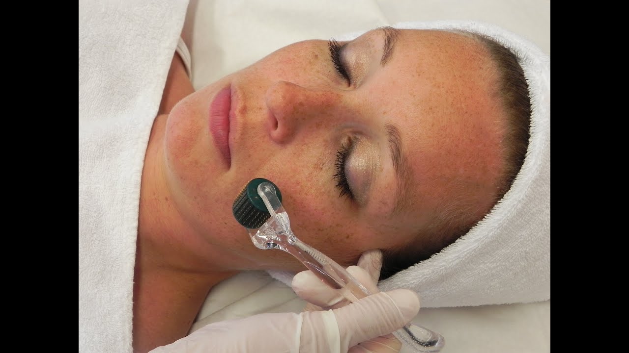 HOW TO INCREASE COLLAGEN AND REDUCE WRINKLES: banishacnescars.com