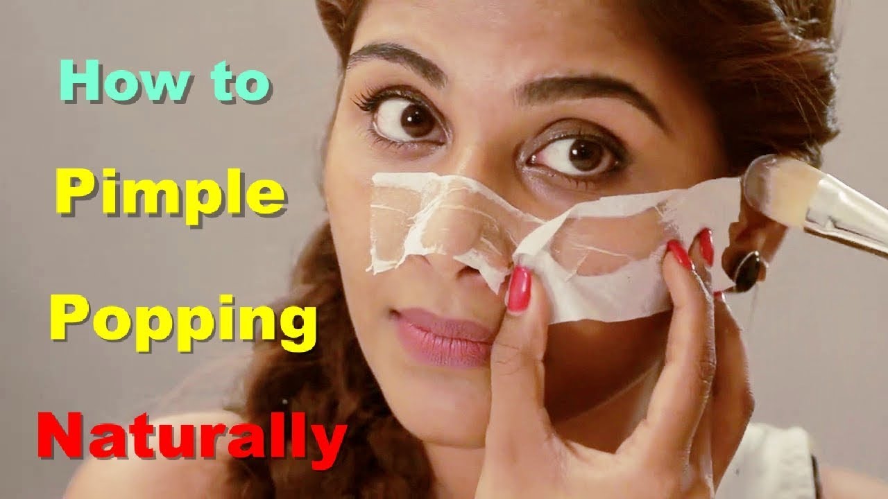 How to Pimple Popping Naturally Pimple Popping Blackheads And Whiteheads Pimple Popping Home Remedy
