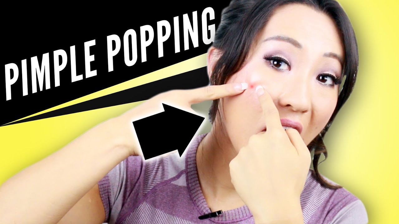 HOW TO POP A PIMPLE