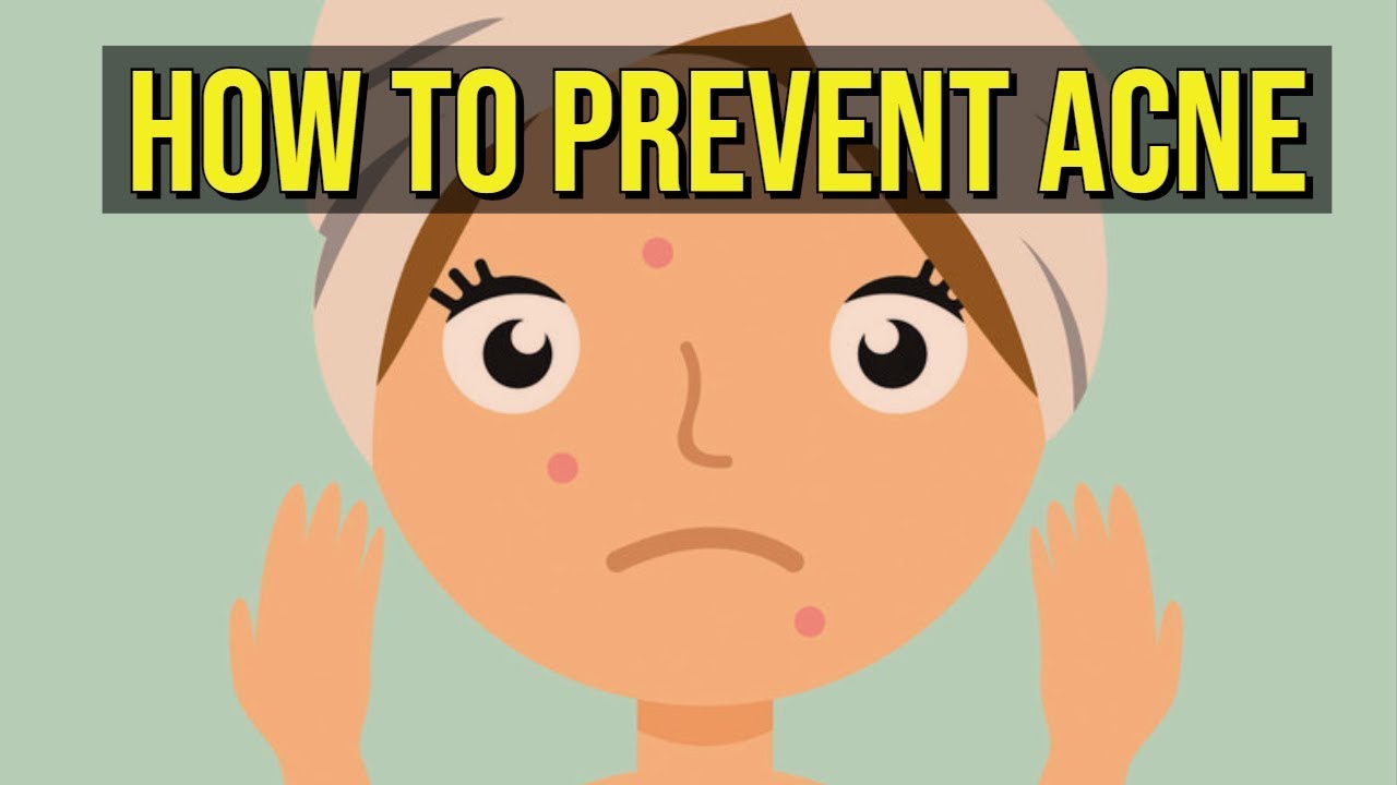 How To Prevent Acne 5 QUICK TIPS
