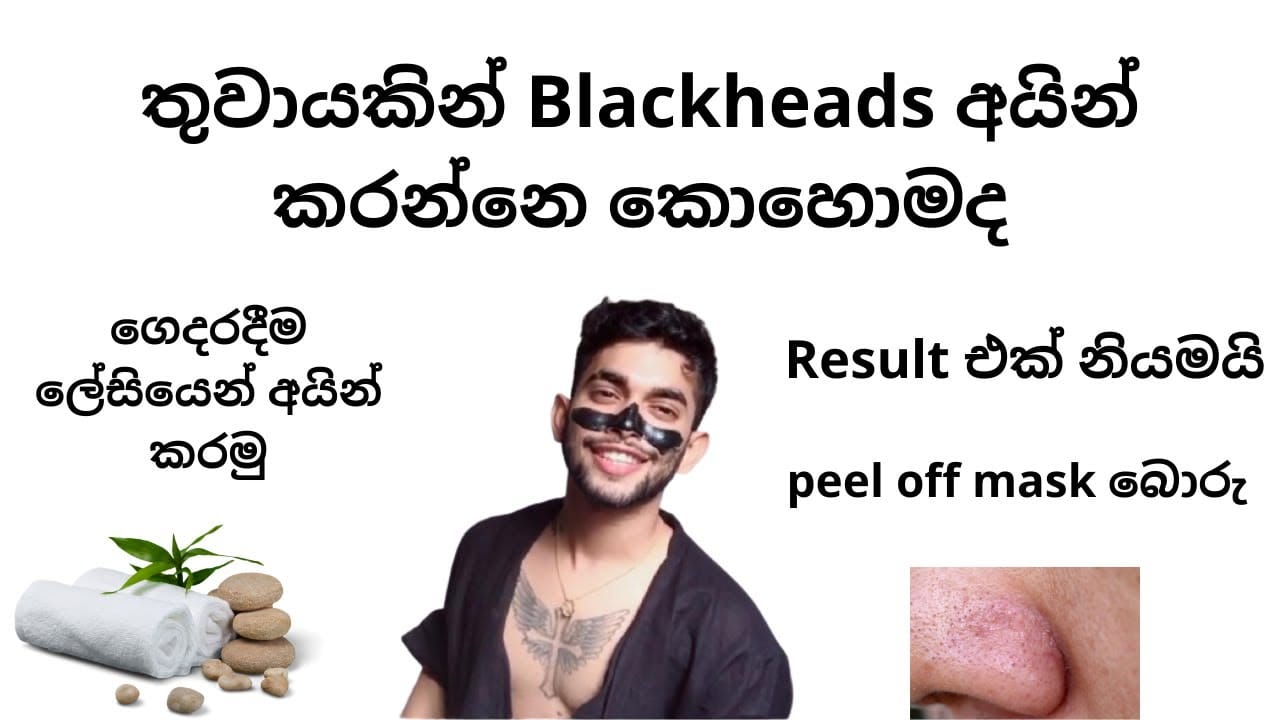 HOW TO REMOVE BLACKHEADS AND WHITEHEADS AT HOME (SINHALA)