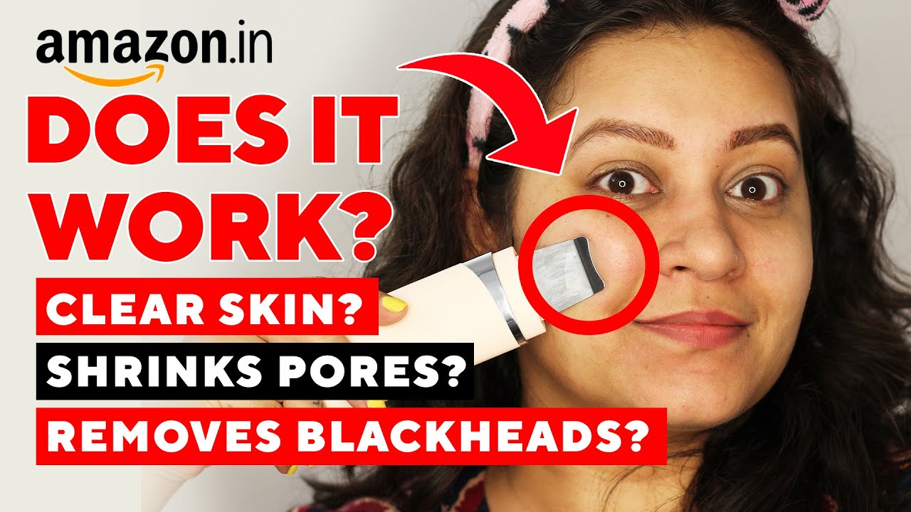HOW TO REMOVE BLACKHEADS || Tried Skin Spatula FOR 1ST TIME || ULTRA SONIC SKIN SCRUBBER || INDIA