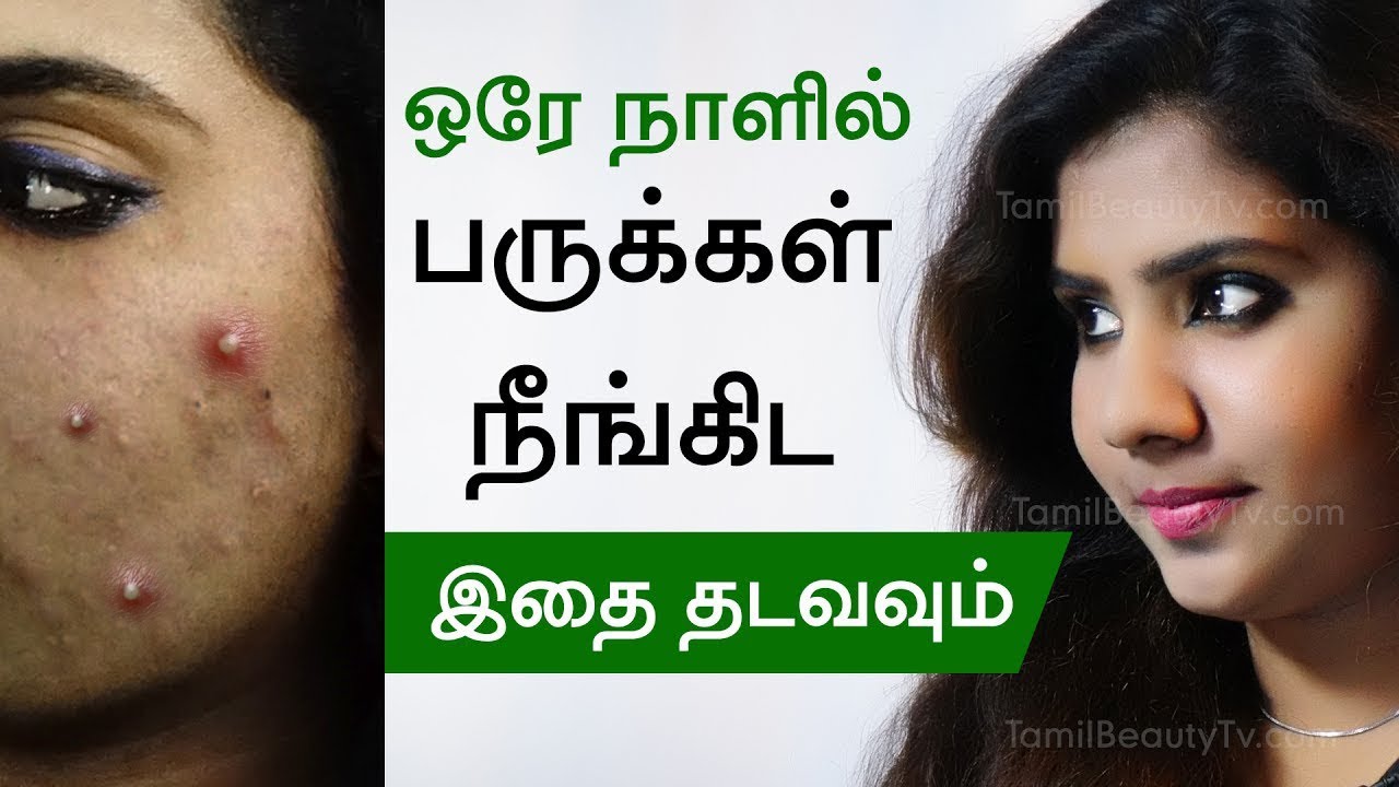 How to remove pimple? –  Home remedies for pimples – Beauty Tips in Tamil
