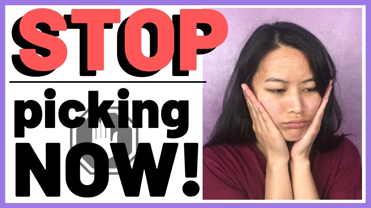 HOW TO STOP PICKING SKIN – 5 Ways to Finally Stop Popping Pimples