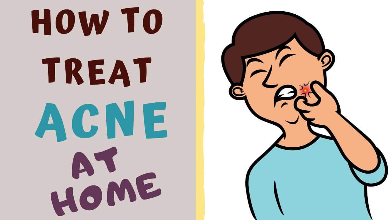 HOW TO TREAT ACNE AT HOME. Acne- All you need to know.
