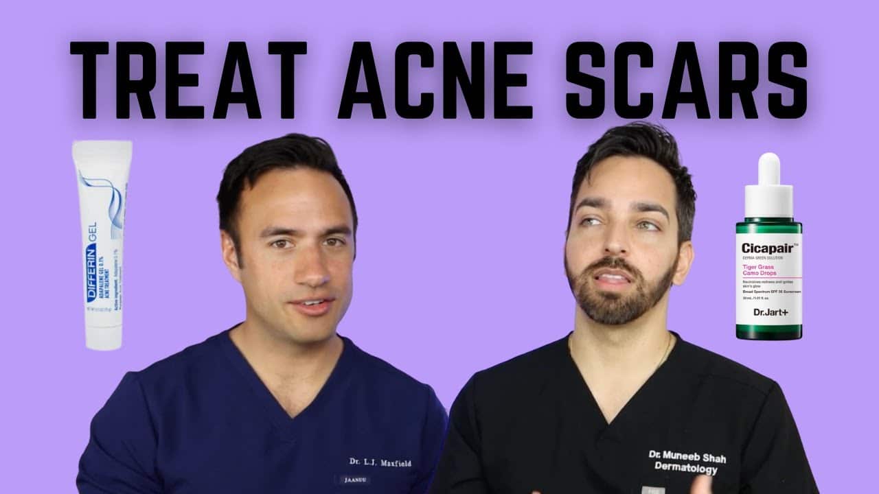HOW TO TREAT ACNE SCARS | DOCTORLY