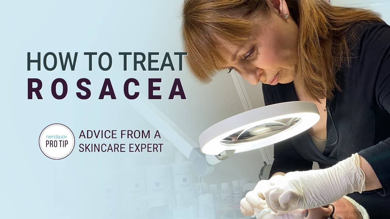 How to Treat Rosacea – Advice from a Skincare Expert